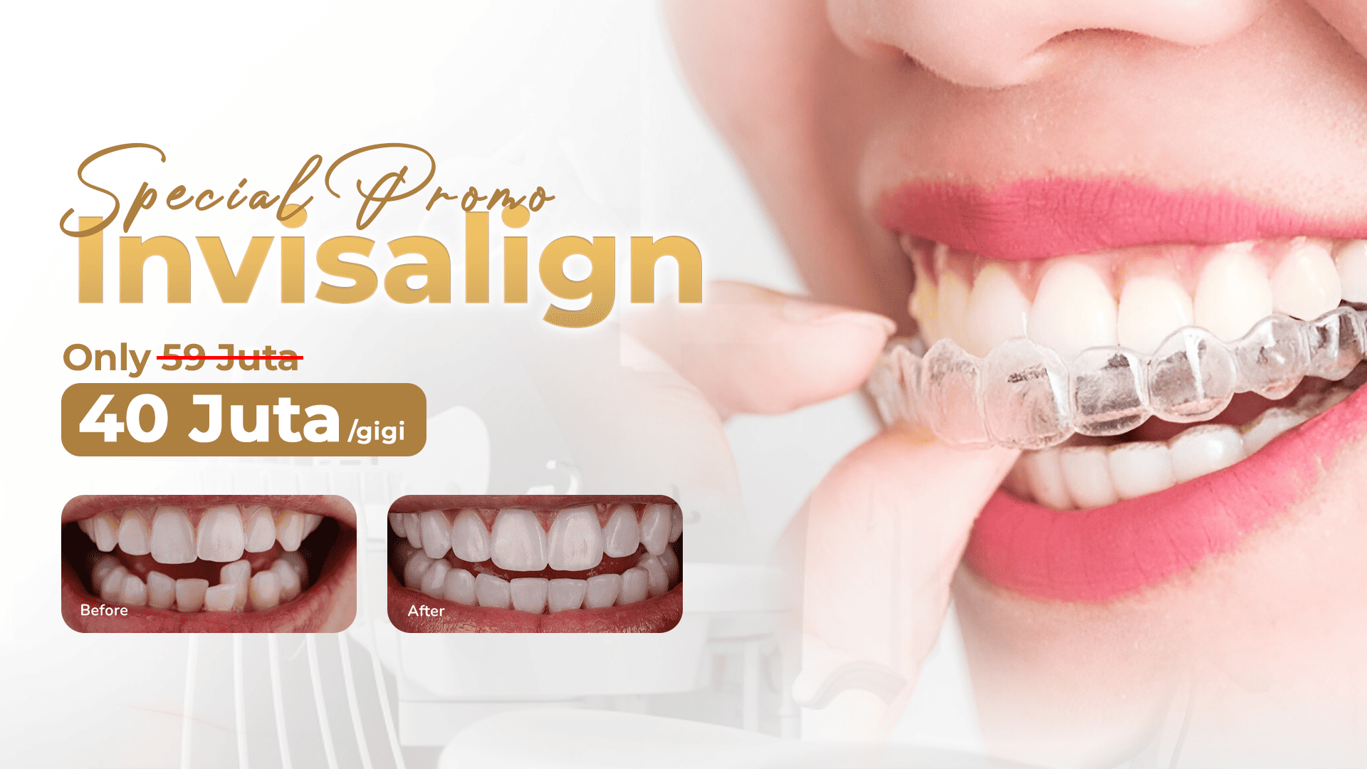 Smile Lab Hero Slide 3